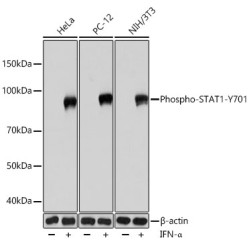 Phospho-STAT1-Y701 Rabbit mAb