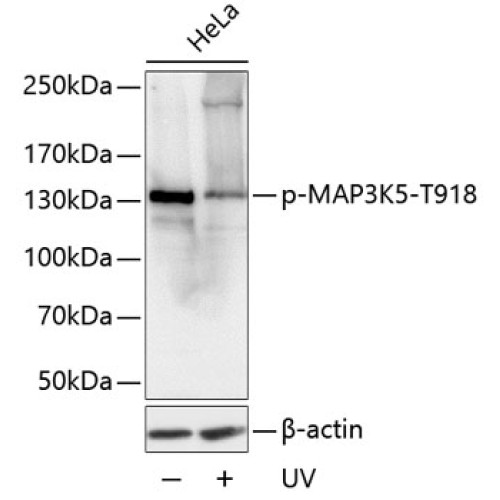Phospho-MAP3K5-T918 Rabbit pAb