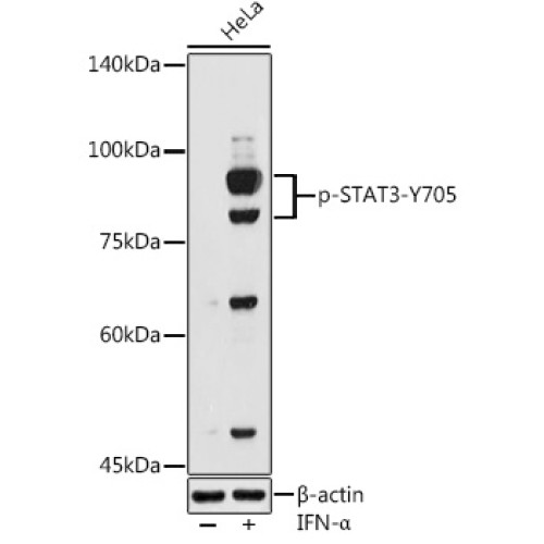 Phospho-STAT3-Y705 Rabbit pAb