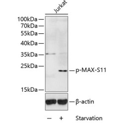 Phospho-MAX-S11 Rabbit pAb