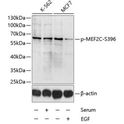 Phospho-MEF2C-S396 Rabbit pAb