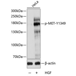 Phospho-MET-Y1349 Rabbit pAb