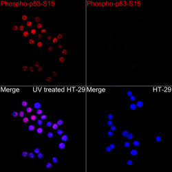 Phospho-p53-S15 Rabbit pAb