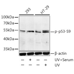 Phospho-p53-S9 Rabbit pAb