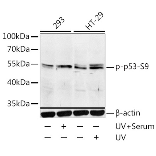 Phospho-p53-S9 Rabbit pAb