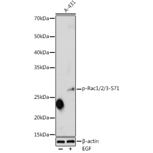 Phospho-Rac1/2/3-S71 Rabbit pAb
