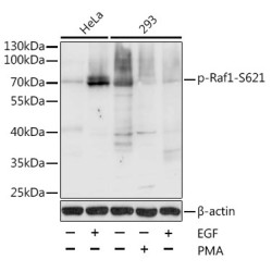 Phospho-Raf1-S621 Rabbit pAb