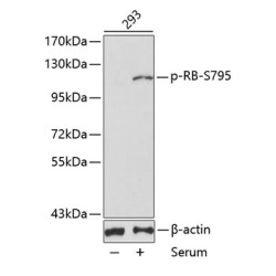 Phospho-RB-S795 Rabbit pAb