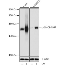 Phospho-SMC1-S957 Rabbit pAb