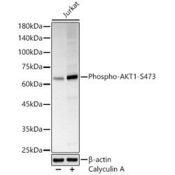 Phospho-AKT1-S473 Rabbit pAb