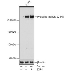 Phospho-mTOR-S2448 Rabbit mAb