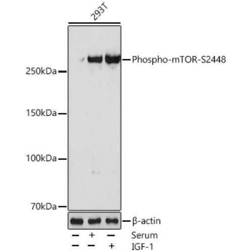 Phospho-mTOR-S2448 Rabbit mAb