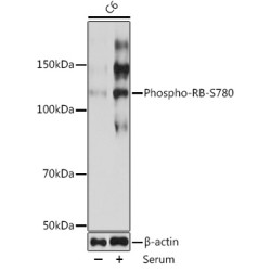 Phospho-RB-S780 Rabbit mAb