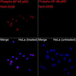 Phospho-NF-kB p65/RelA-S536 Rabbit pAb