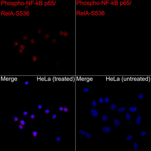 Phospho-NF-kB p65/RelA-S536 Rabbit pAb