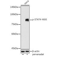 Phospho-STAT4-Y693 Rabbit pAb