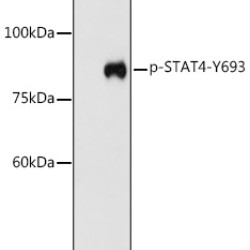 Phospho-STAT4-Y693 Rabbit pAb