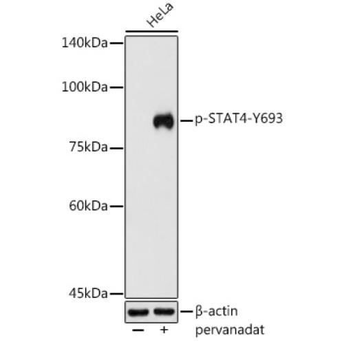 Phospho-STAT4-Y693 Rabbit pAb