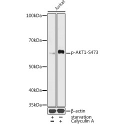 Phospho-AKT1-S473 Rabbit pAb