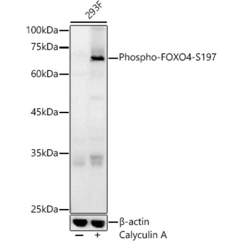 Phospho-FOXO4-S197 Rabbit pAb