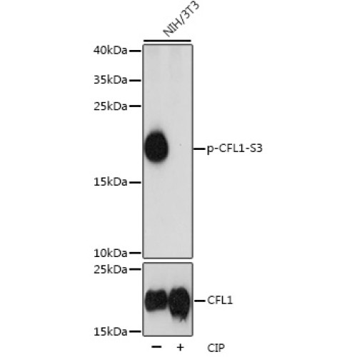 Phospho-CFL1-S3 Rabbit pAb