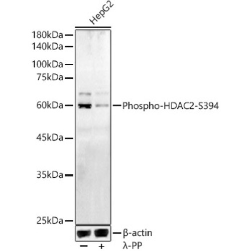 Phospho-HDAC2-S394 Rabbit pAb
