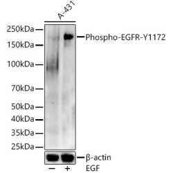 Phospho-EGFR-Y1172 Rabbit pAb