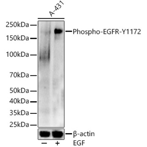 Phospho-EGFR-Y1172 Rabbit pAb