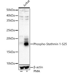 Phospho-Stathmin 1-S25 Rabbit pAb