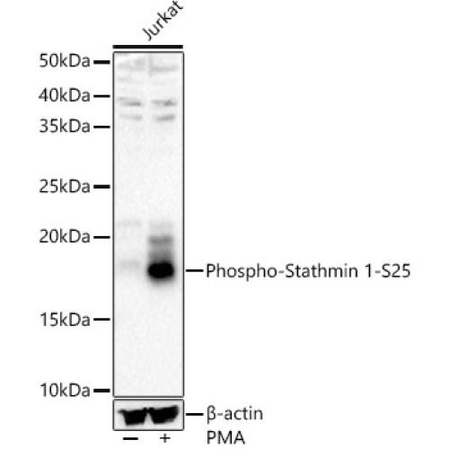 Phospho-Stathmin 1-S25 Rabbit pAb