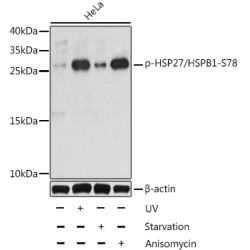 Phospho-HSP27/HSPB1-S78 Rabbit pAb
