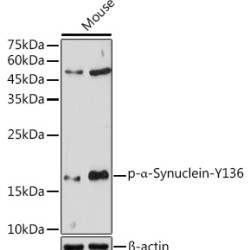 Phospho-α-Synuclein-Y136 Rabbit pAb