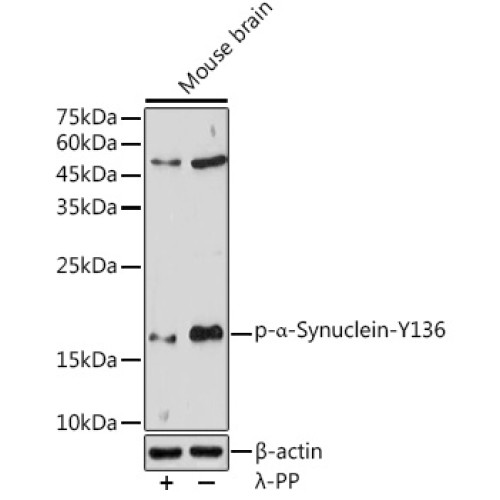Phospho-α-Synuclein-Y136 Rabbit pAb