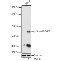 Phospho-Smad2-S467 Rabbit pAb