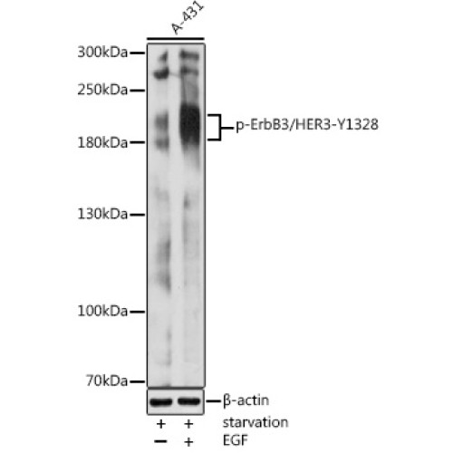 Phospho-ErbB3/HER3-Y1328 Rabbit pAb