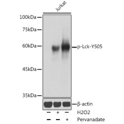 Phospho-Lck-Y505 Rabbit pAb