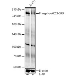 Phospho-ACC1-S79 Rabbit pAb