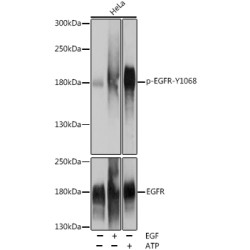 Phospho-EGFR-Y1068 Rabbit pAb