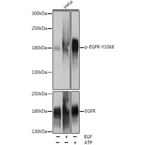 Phospho-EGFR-Y1068 Rabbit pAb
