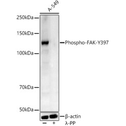 Phospho-FAK-Y397 Rabbit pAb