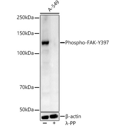 Phospho-FAK-Y397 Rabbit pAb