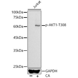 Phospho-AKT1-T308 Rabbit pAb