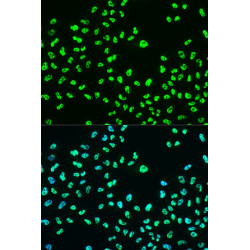 Phospho-BRCA1-S988 Rabbit pAb