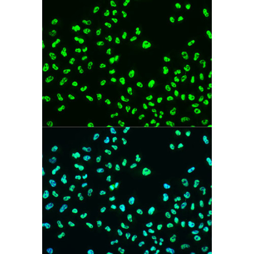 Phospho-BRCA1-S988 Rabbit pAb