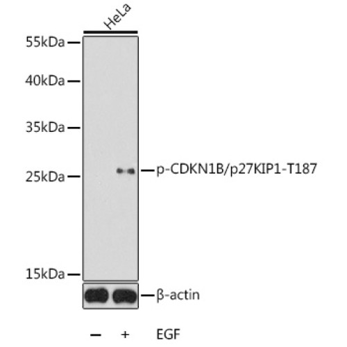 Phospho-CDKN1B/p27KIP1-T187 Rabbit pAb