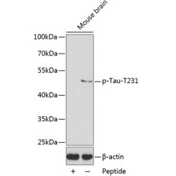 Phospho-Tau-T231 Rabbit pAb