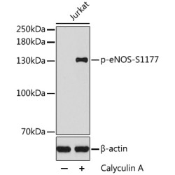 Phospho-eNOS-S1177 Rabbit pAb