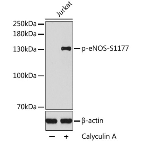 Phospho-eNOS-S1177 Rabbit pAb