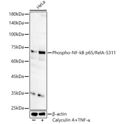 Phospho-NF-kB p65/RelA-S311 Rabbit pAb