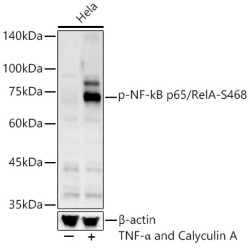 Phospho-NF-kB p65/RelA-S468 Rabbit pAb